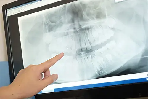 歯科の画像診断